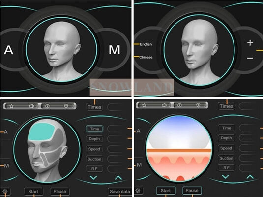 آلة إزالة الشعر بالليزر 808nm مع مستشعر اتصال بالجلد