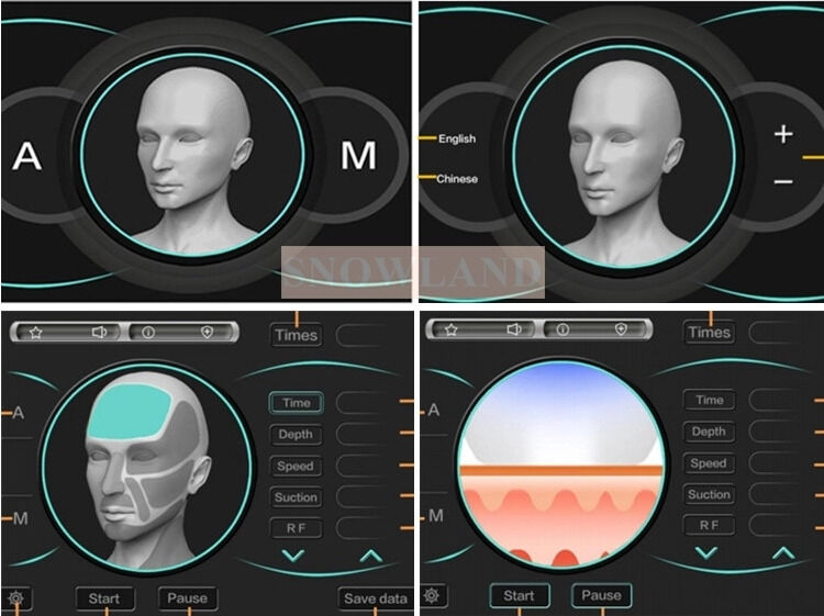 آلة إزالة الشعر بالليزر 808nm مع مستشعر اتصال بالجلد